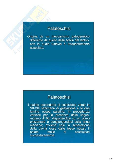 Illustrazione della palatoschisi congenita