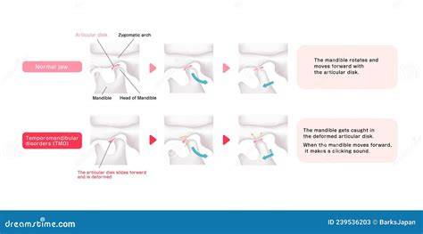 Illustrazione comparativa dei diversi tipi di cardatori WIDU® in base alla lunghezza e dimensione dei denti