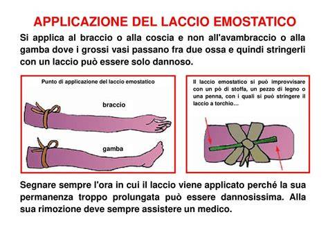 Immagine storica di un laccio maschile per sostenere le calze