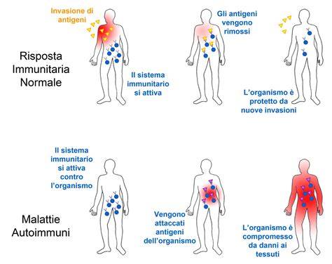 Illustrazione del sistema immunitario e malattie autoimmuni