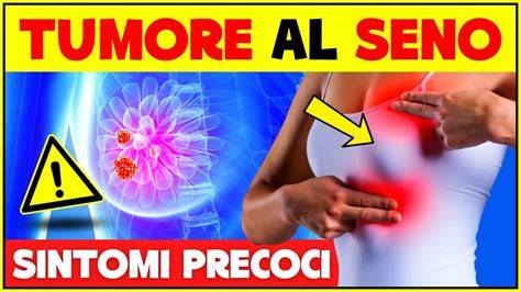 Illustrazione dei segnali d'allarme del tumore al seno